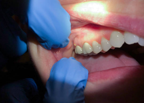 Best Orthodontic Emergency Dentist in Cheat Lake, WV